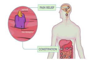 Opioids causing constipation